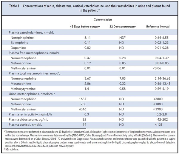 Table 1. Concentrations of renin, aldosterone, cortisol, catecholamine, and their metabolities in urine and plasma found in the patient