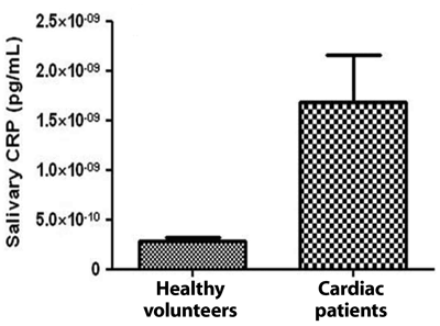 Salivary CRP levels in healthy volunteers (n = 55) and in patients with ischemic heart disease (n = 28)