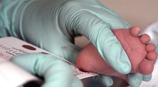 A clinician takes a heelstick blood sample from a newborn for phenylketonuria testing.